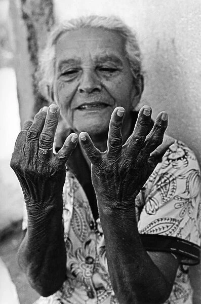 An old woman counts out her age on her fingers