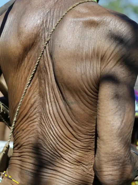 Framed Print : The heavily wrinkled skin of a very old N